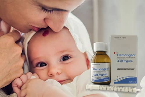 hemangeol baby bottle